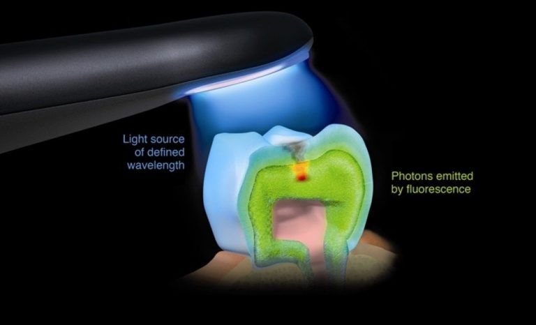 SOPROLIFE® diagnostic camera technology at Lifetime Smiles